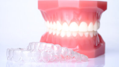 wondering if braces will financially drain you? not anymore