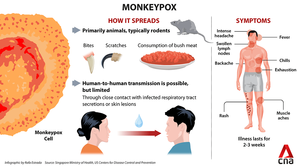 monkeypox infographic