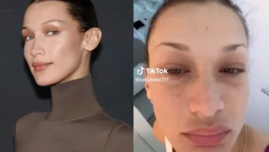 Lyme Disease: Unraveling the Tick-Borne Illness Supermodel Bella Hadid Suffers From