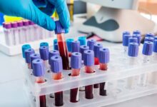 Top 10 Diagnostic Chains In 2026