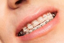 Top 10 Dental Chains In 2026