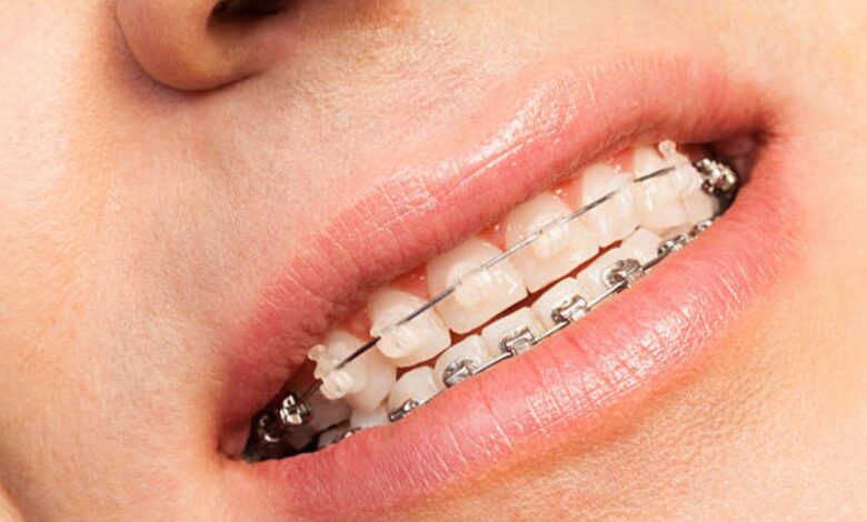 Top 10 Dental Chains In 2026